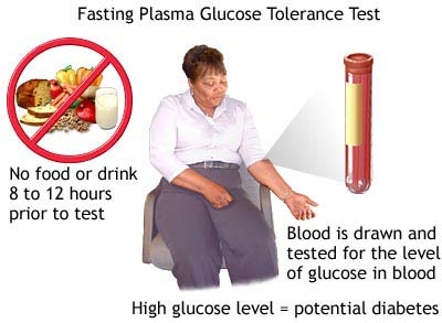 Fasting Plasma Glucose Tolerence test